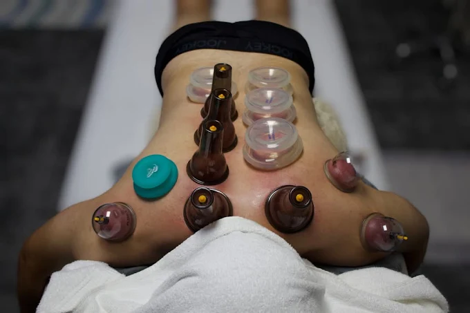 Cupping therapy session detail